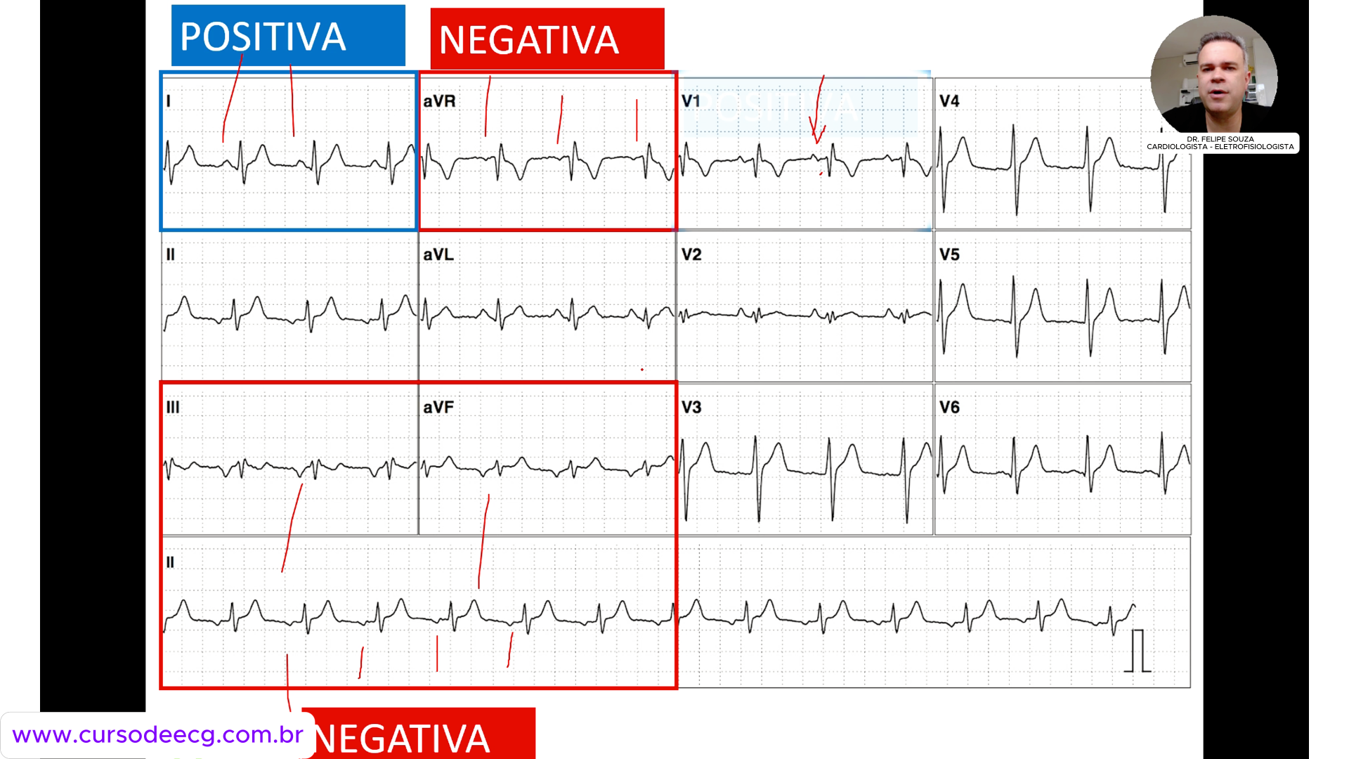 Aula do curso online de ECG para iniciantes
